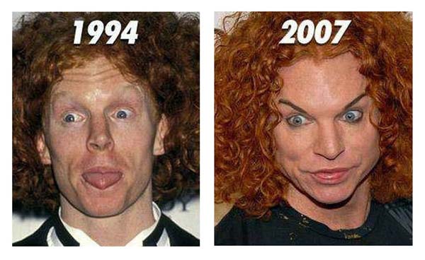 Carrot Top before and after steroids and plastic surgery