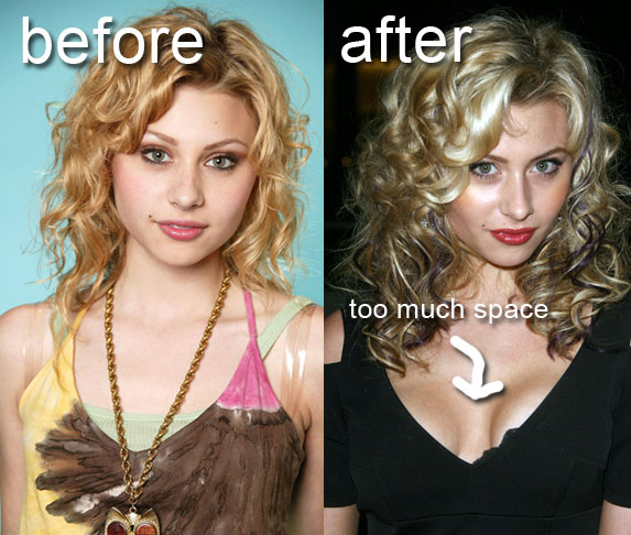 Aly Michalka efore and after