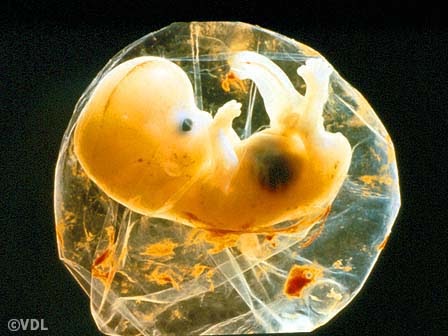 Science Enrichment: From Zygote to Baby in Mrs. Burnham's class