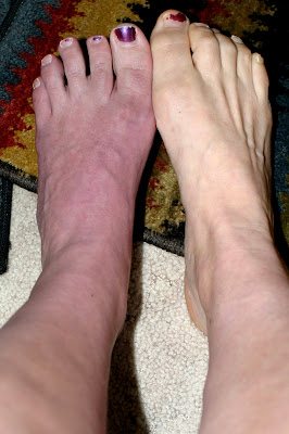 purple foot yes grossed hurt cool family