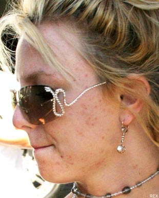 المشاهير بمكياج و بدون مكياج Britney
