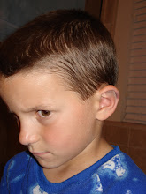 Nicholas's bruised ear