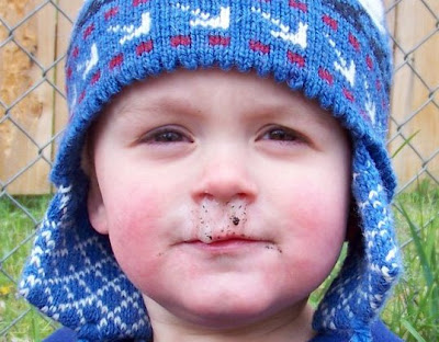 Kid With Snot
