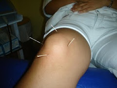 ACUPUNTURA EN LA RODILLA