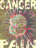 Cancer Pain