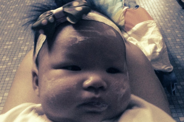 newborn heat rash on face. heat rash on face pictures.