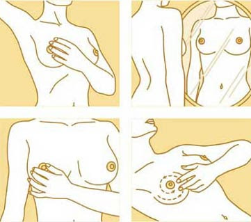 Cancro Mama