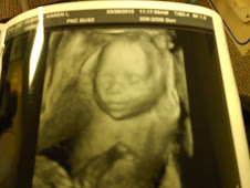 3D Ultrasound at 21 Weeks