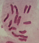 Cromosomas de Haba (Vicia faba L)