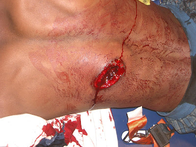 Five people were stabbed in