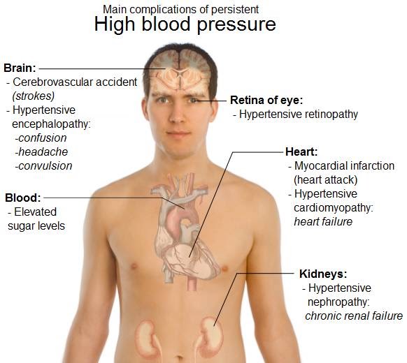 TREAT WITH THE WHOLEHEARTED hypertension crisis 1