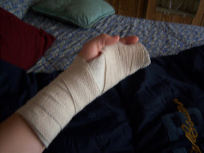 Hand Broken