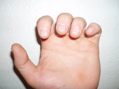Fingernails