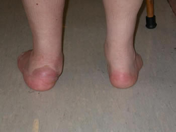 [Flat+Foot+post+view..jpg]