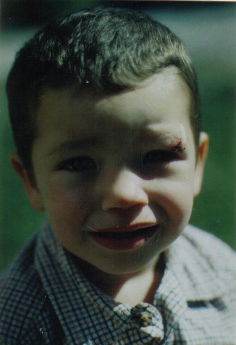 [Ethan's+Cut+Eye.JPG]