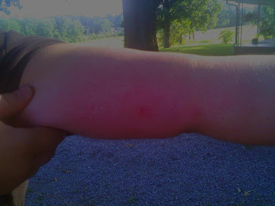 spider bites on dogs. spider spider bite on dog pictures. spider bites on dogs. spider