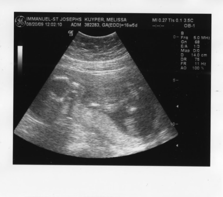 Ultrasound 20 Weeks