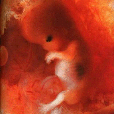 Fetus+at+6+weeks+gestation fetus at 6 weeks. Fetus+at+6+weeks+gestation