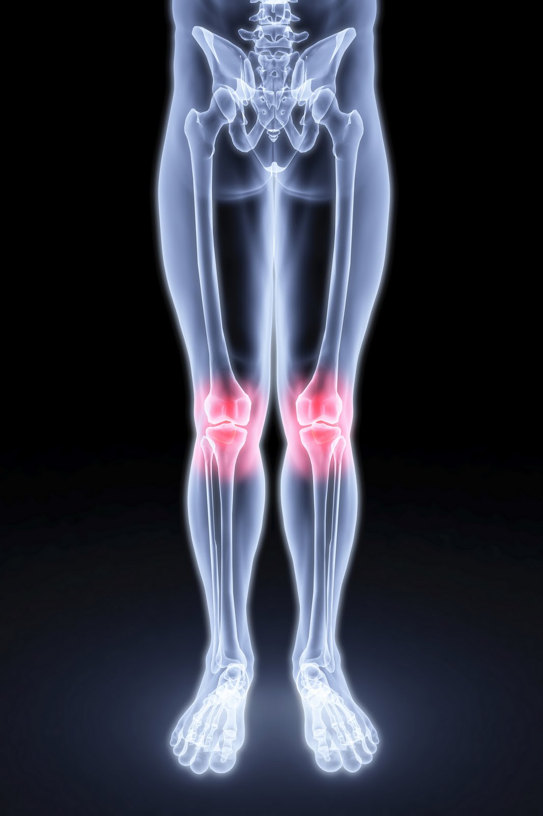 Insights into Therapy for Pain Relief Assist Knee Joint Pain