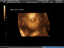 Baby Chase 3D 28 weeks