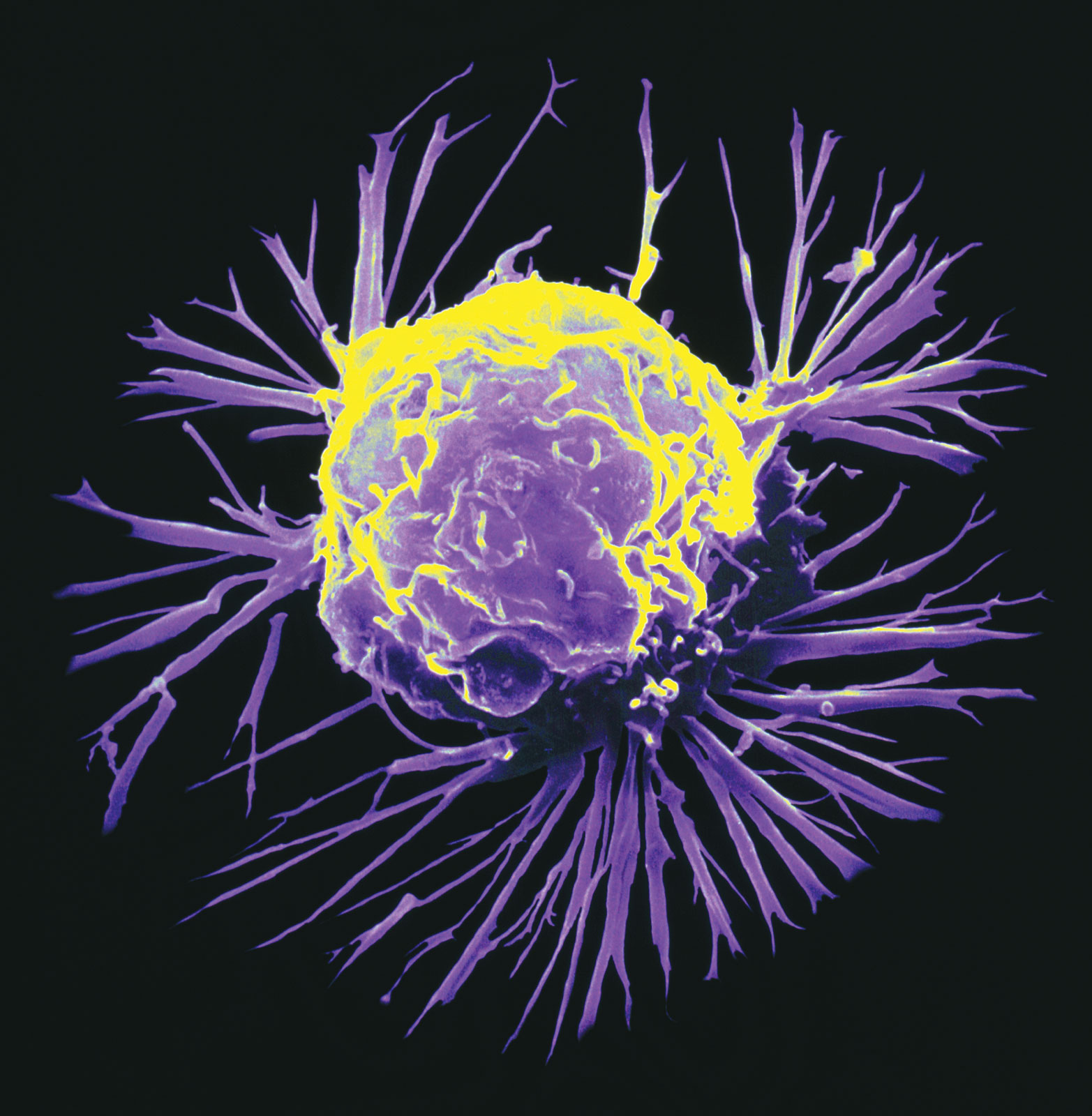 http://1.bp.blogspot.com/_eq9Ae3PzIVE/TNpyYJ6YtiI/AAAAAAAANAI/uomFnso3ax0/s1600/cancercell.jpg