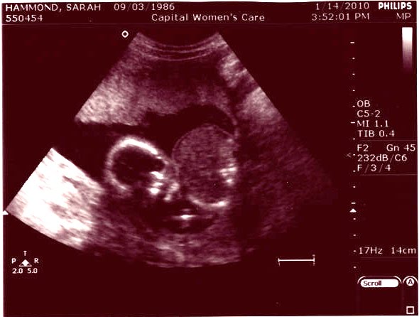 [Baby.jpg]