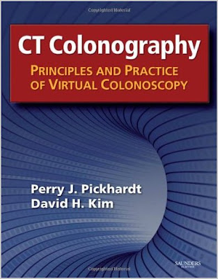 CT Colonography: Principles and Practice of Virtual Colonoscopy Ct+colonography