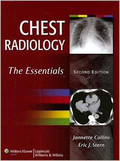 Chest Radiology: The Essentials CHEST+RADIOLOGY
