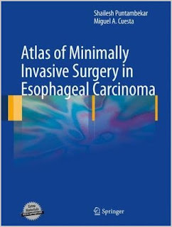 Atlas of Minimally Invasive Surgery in Esophageal Carcinoma Surgery+carcinoma