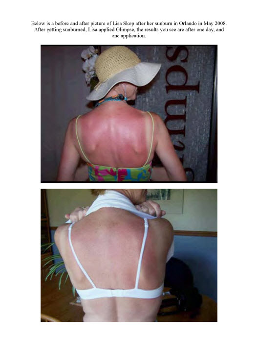 AN OVERNIGHT GLIMPSE SUCCESS STORY!