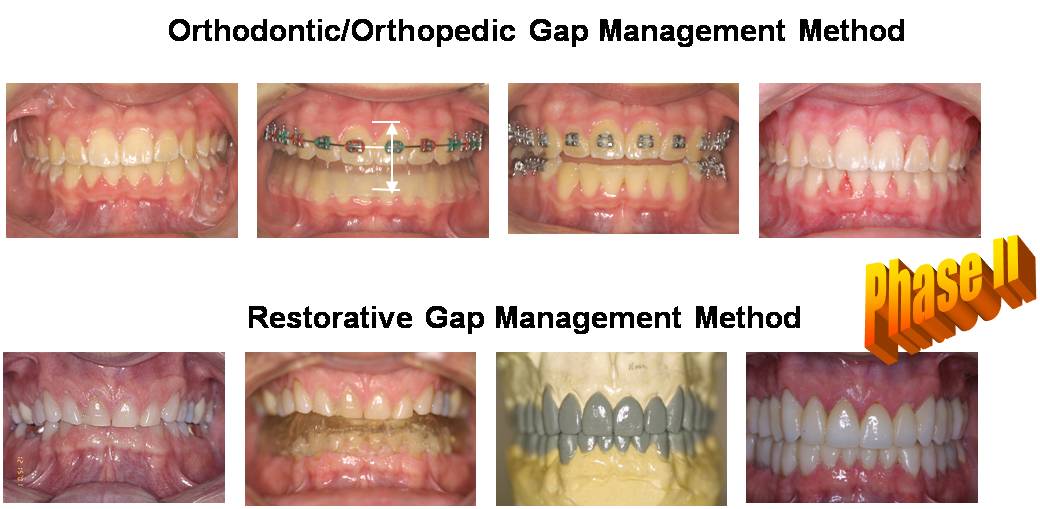 [Neuromuscular+Dentistry+Physiologic+Dentistry.jpg]