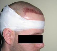 POST 2500 FUE First Look