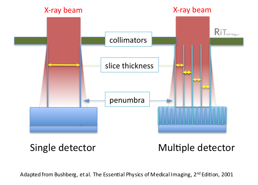 RiT radiology CT Slice Thickness