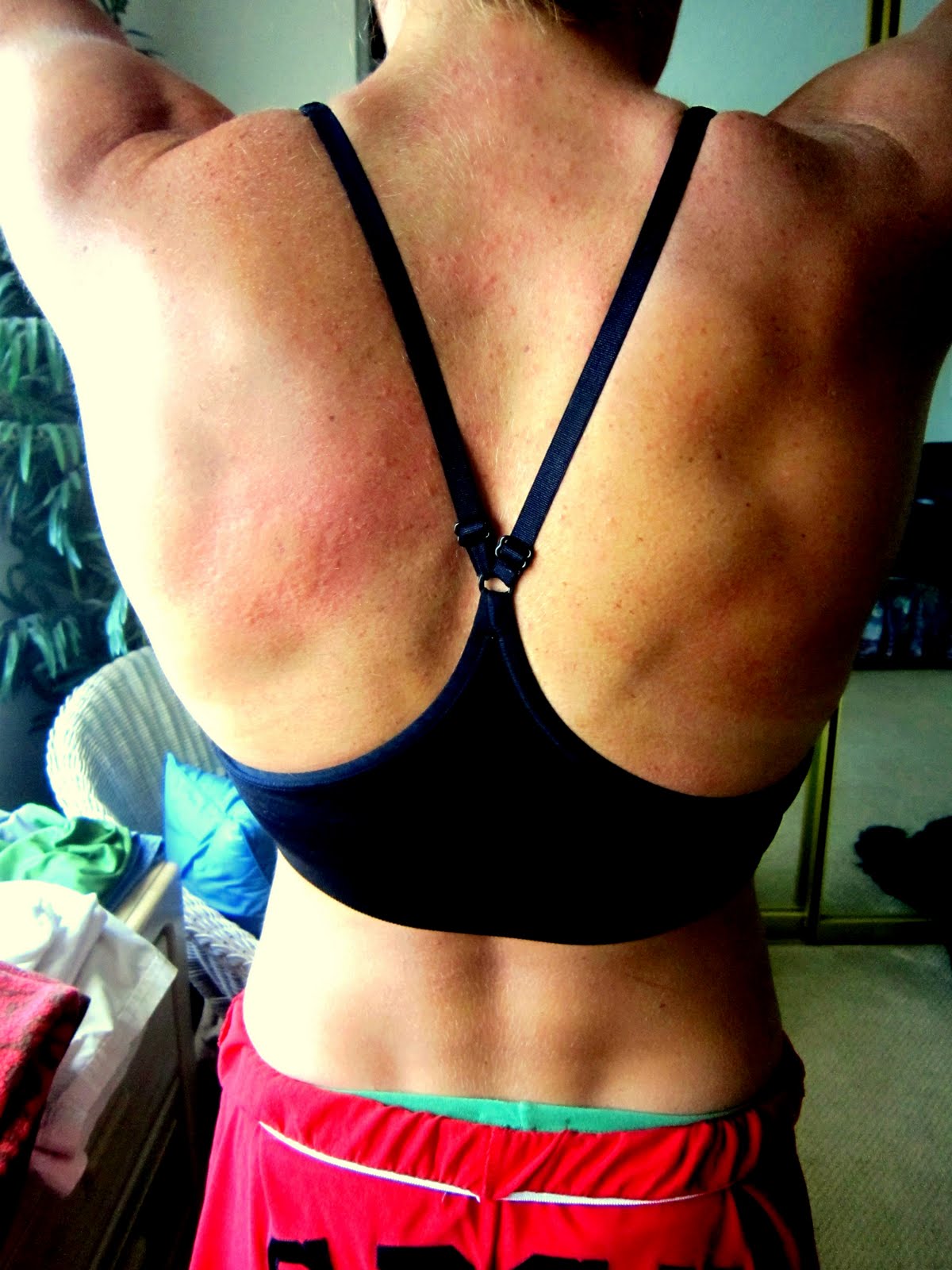 Gym Rash