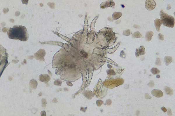 Nose Mites