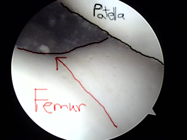 [knee2.bmp]