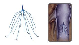 Ivc Umbrella