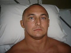 4 days after Surgery