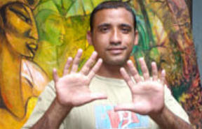 Un joven cubano con 24 dedos asegura que lleva una vida normal Cubano+con+24+dedos