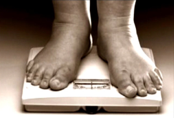 feet weight loss foot obesity fix success obese problems footcare clinic advanced
