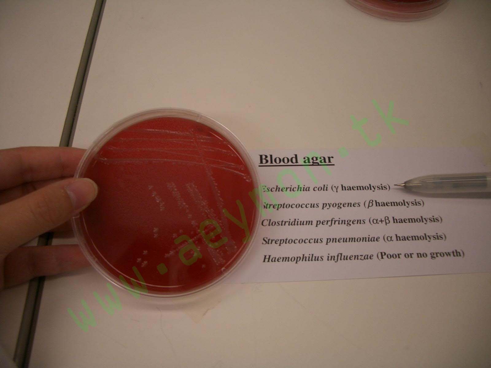http://1.bp.blogspot.com/_h8swaZWFcE8/TRjq96gtL0I/AAAAAAAABbU/8-5_tyyUvrM/s1600/blood+agar.jpg