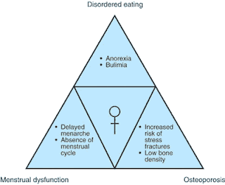 fitness competition female athlete triad syndrome fitness competition female athlete triad syndrome