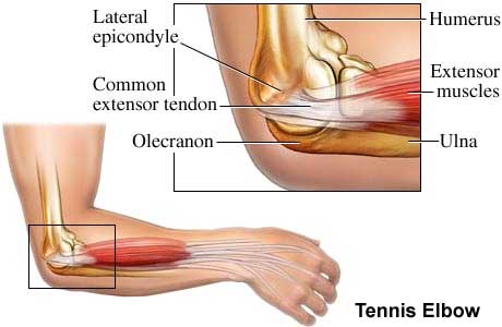 inflamed wrist