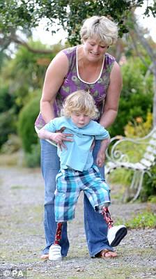 [engelsizdunyamprotezcocuk2.jpg]