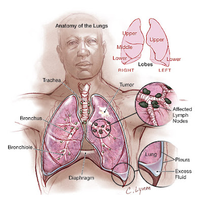 Lung Cancer drugs found