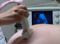 Miscarriage risk minimal if first visit is normal 