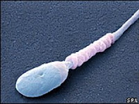 Sperm which have limited movement is a common male fertility problem