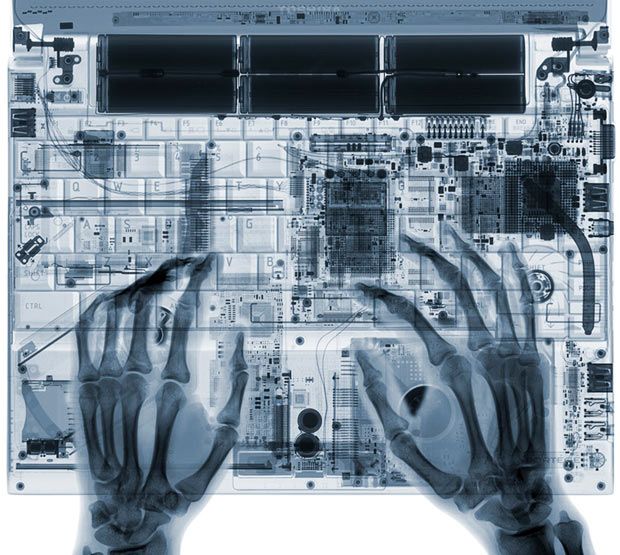 [X_ray_Photos_8.jpg]