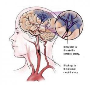 mon amour a rencontre alzheimer