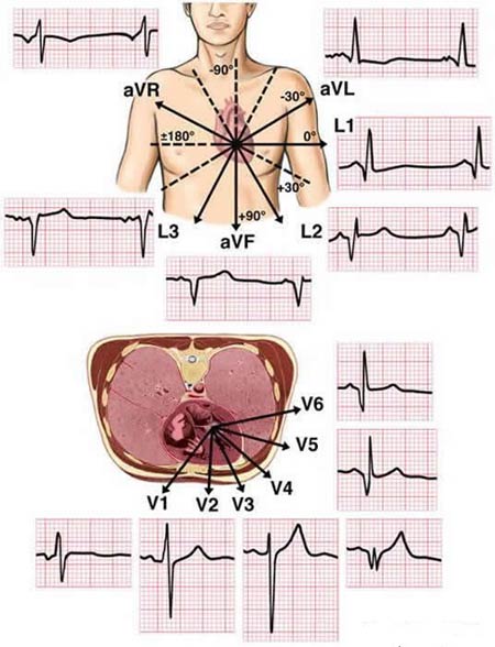 KUSH TRIPATHI: ECG OR EKG 12